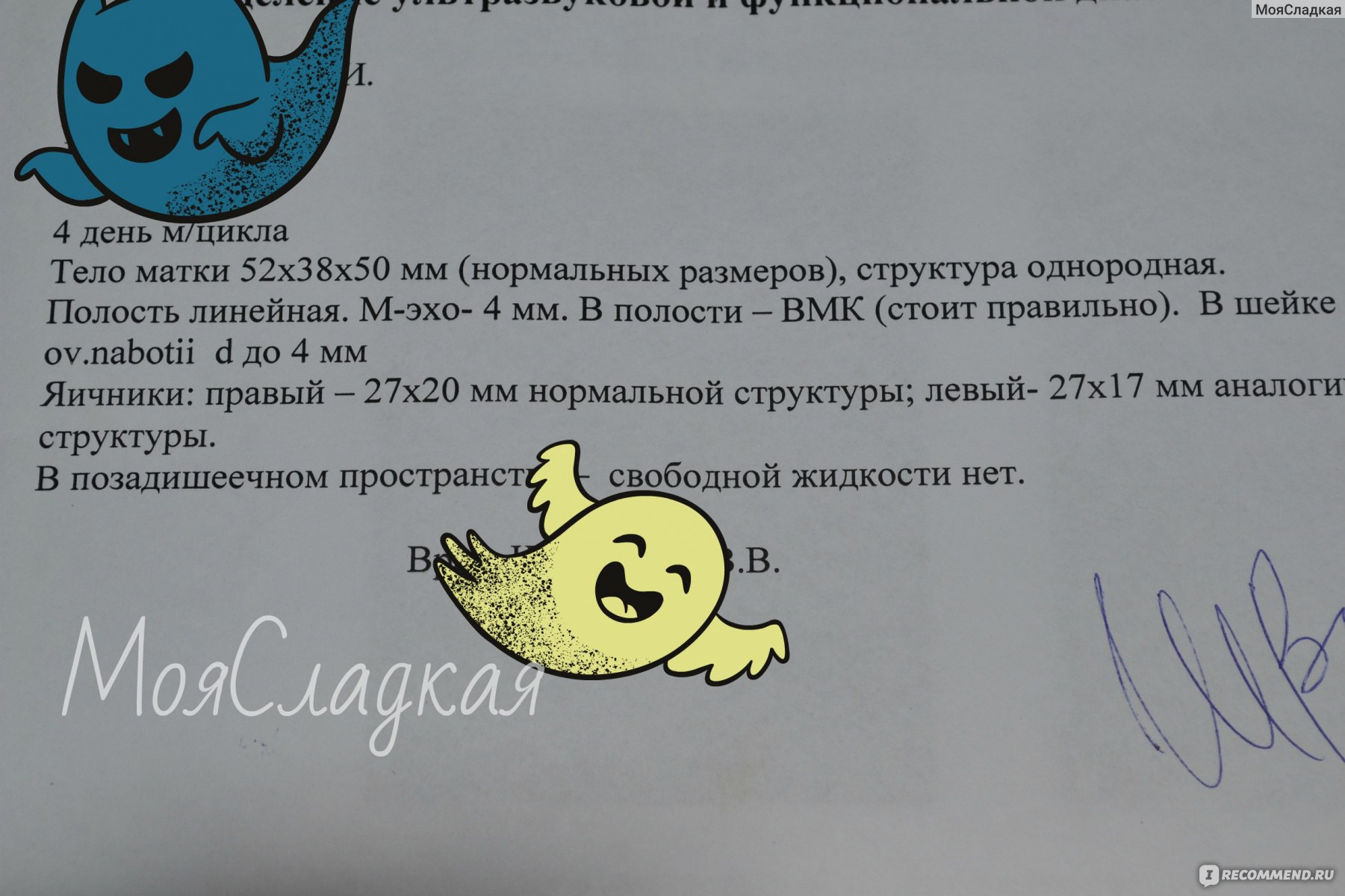 Какая внутриматочная спираль лучше: отзывы женщин Какая внутриматочная спираль лучше: отзывы женщин